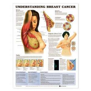   Breast Cancer Anatomical Chart Plastic Styrene