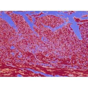 Striated Muscle and Muscle Tissue Colored Micrograph Photographic 