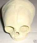Antique Real Human Skull Genuine Medical  