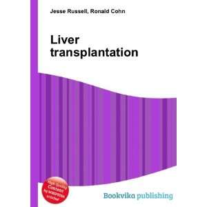  Liver transplantation Ronald Cohn Jesse Russell Books