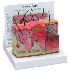 Skin Burn Anatomical Model Normal  Industrial & Scientific